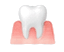 Periodontic Treatment
