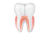 RCT / RBG Technique