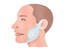 Maxillofacial Surgery